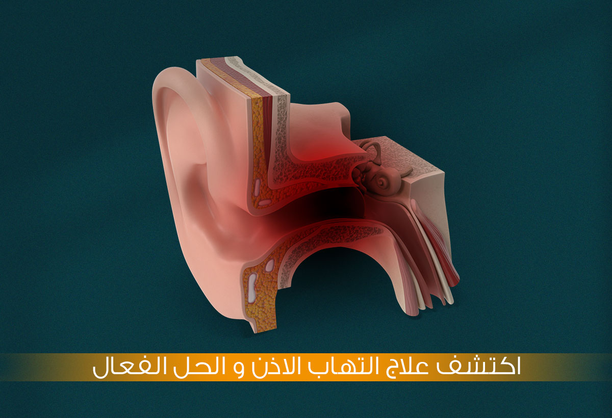 علاج التهاب الأذن